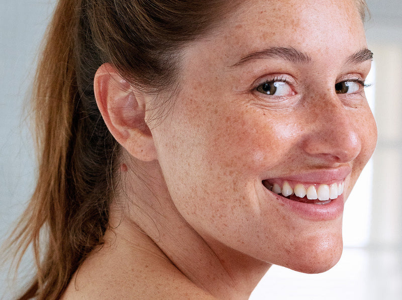 Jeune femme souriante au teint naturel et aux taches de rousseur, peau hydratée et saine en hiver.